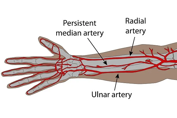 median-artery